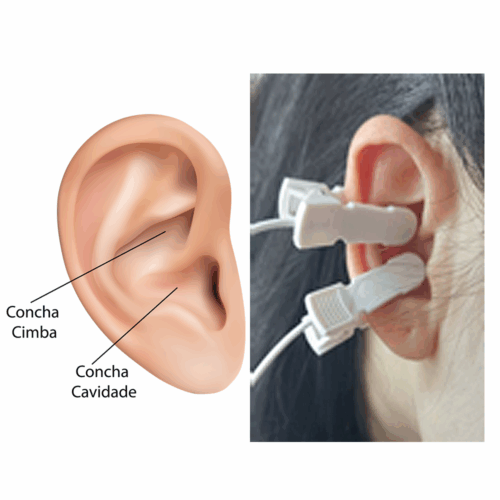 Eletrodo Pró-Fono - Auricular